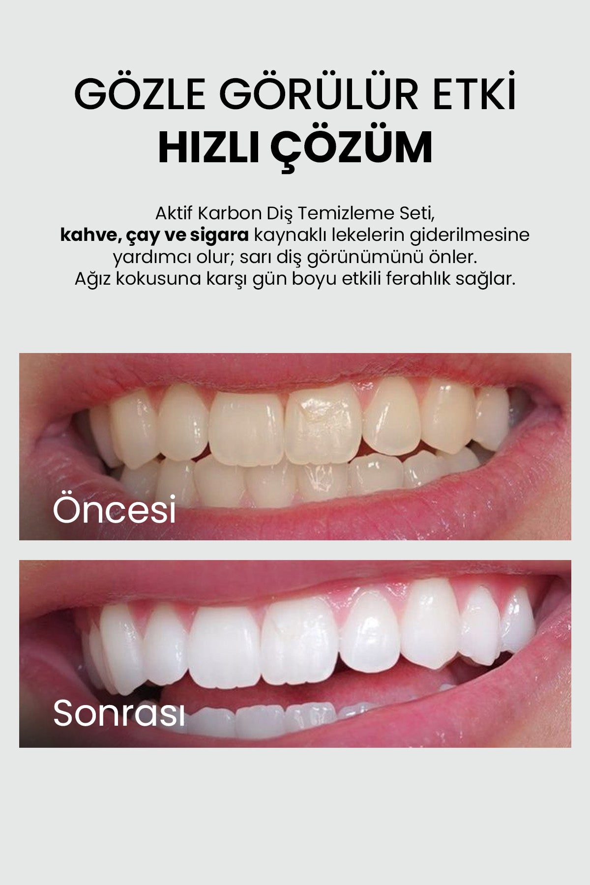 Diş Beyazlatıcı Set + Bambu Diş Fırçası - Luis Bien