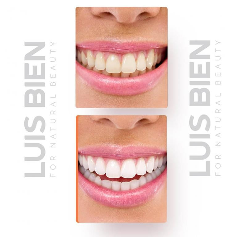 Diş Beyazlatıcı Set - LuisBienWeb