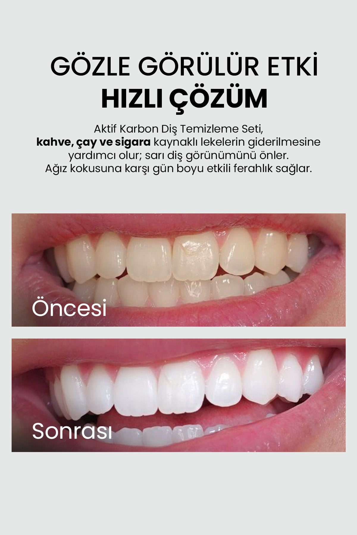 Diş Beyazlatıcı Set - Luis Bien 