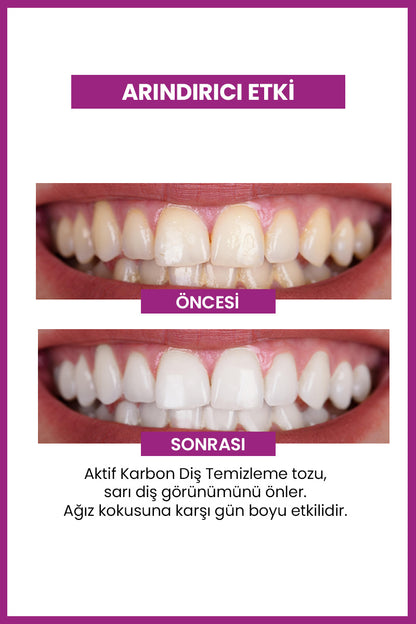 Aktif Karbon Diş Temizleme Tozu