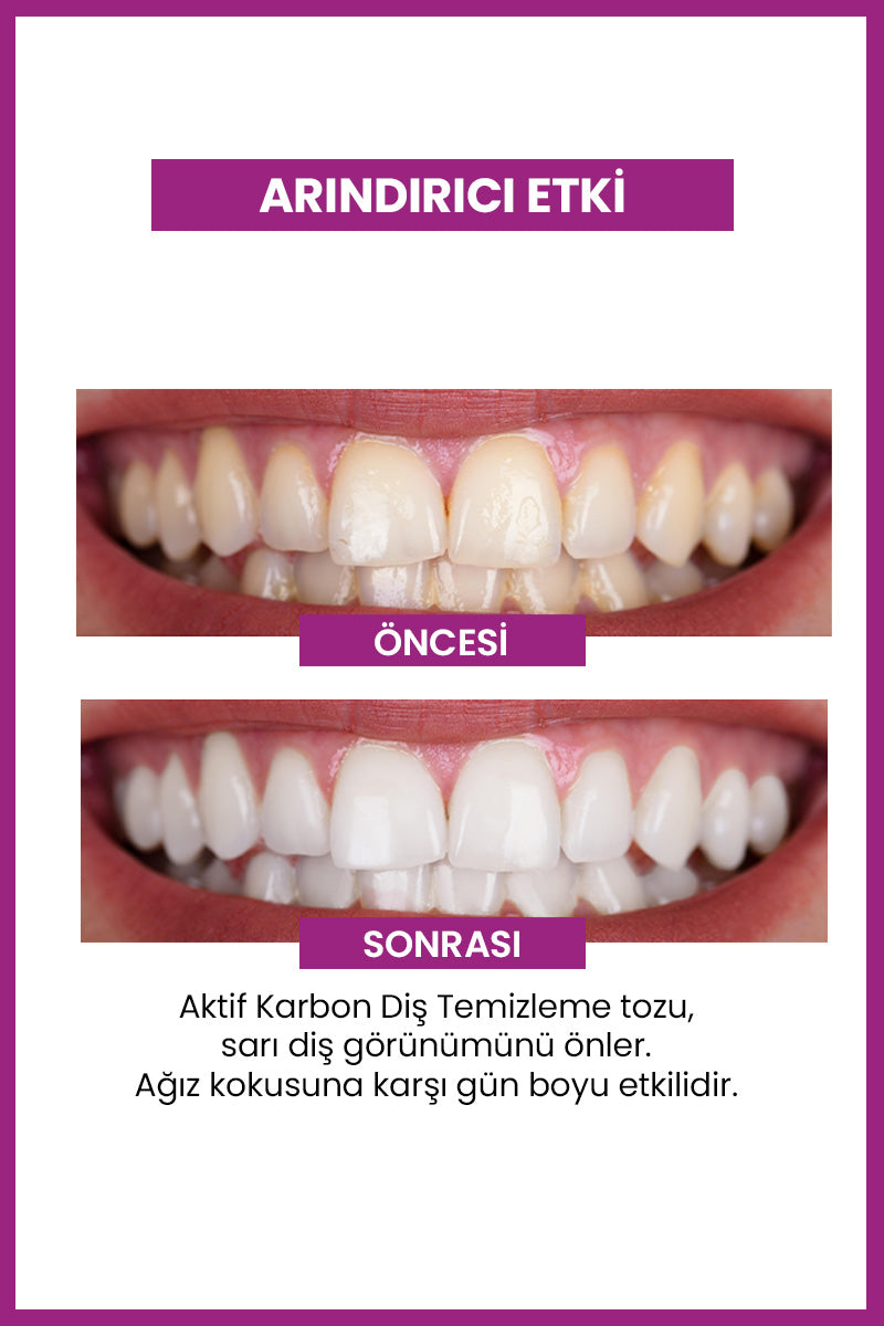 Aktif Karbon Diş Temizleme Tozu