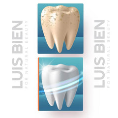 Diş Beyazlatıcı Set - LuisBienWeb